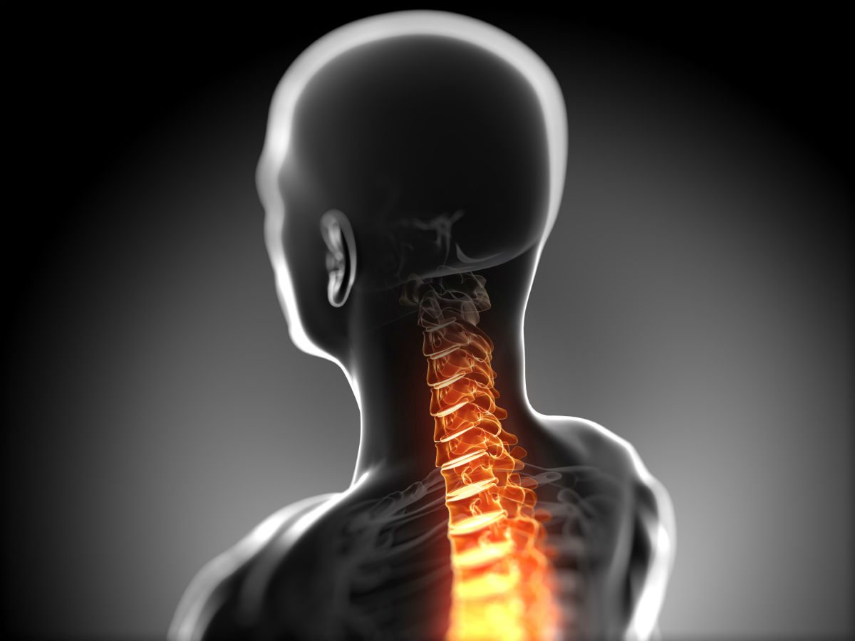 Stenosi Cervicale: Sintomi e Terapie